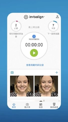 myinvisalign安卓版4