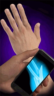 X射线模拟器图2