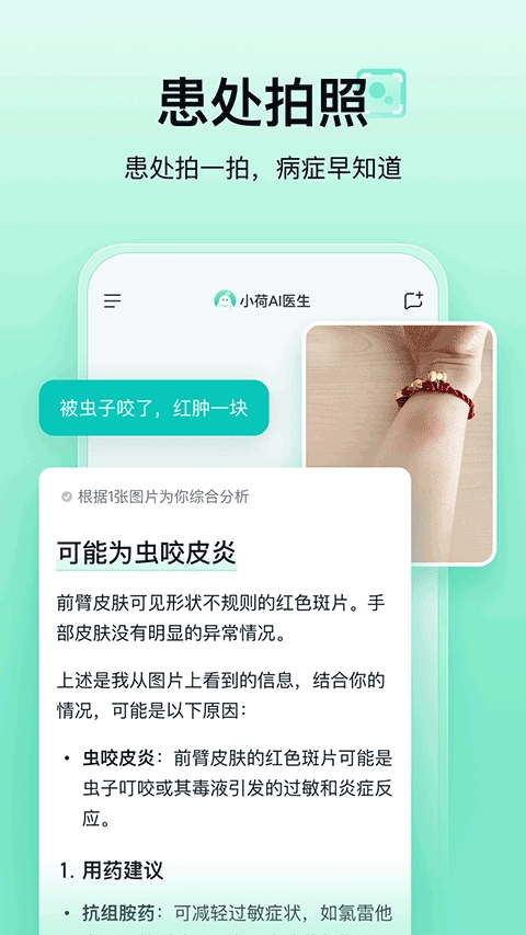 小荷AI医生软件 