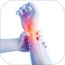 疼痛触发图谱最新版