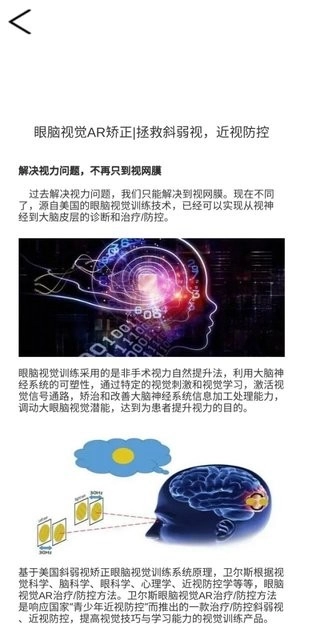 眼视觉图3
