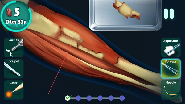 外科医生手术模拟器无限血量手机下载