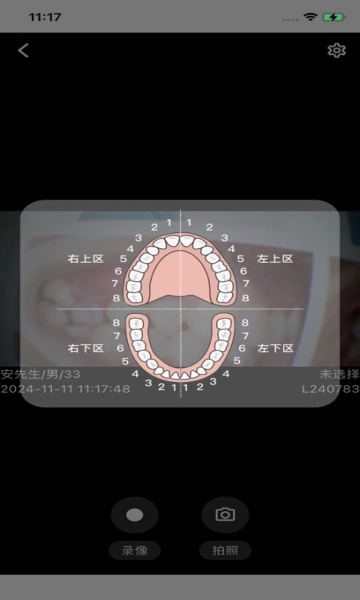 慧视健康口腔观察仪最新版