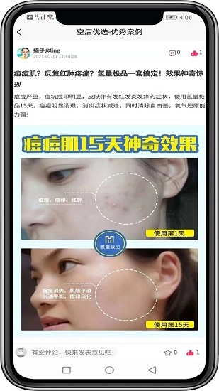 小氢瓶最新版