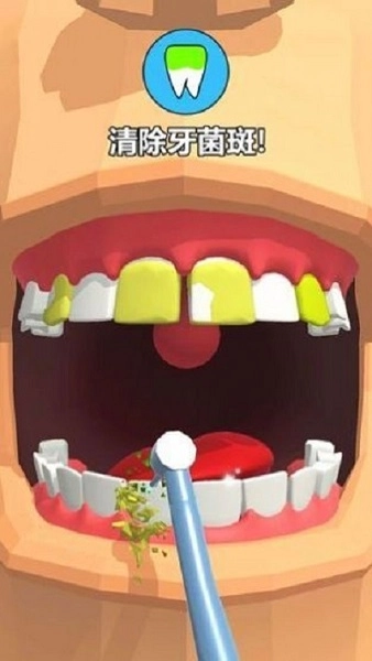 拔牙大师游戏(2)